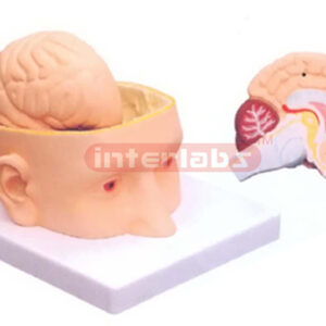 HUMAN HEAD WITH BRAIN