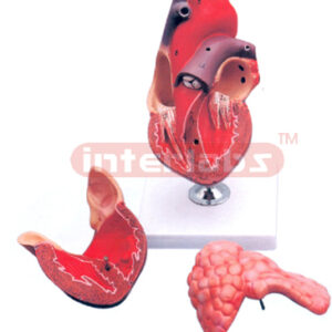 HUMAN HEART, 3 PARTS