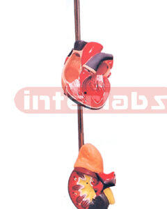 HYPERTENSION MODEL, 6 PARTS