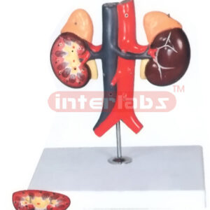HUMAN KIDNEY WITH VESSEL