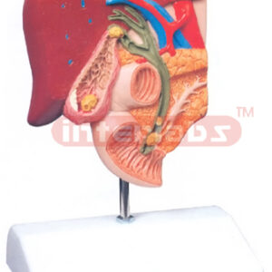 GALLSTONE