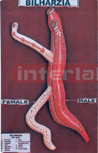 BILHARZIA, MALE AND FEMALE