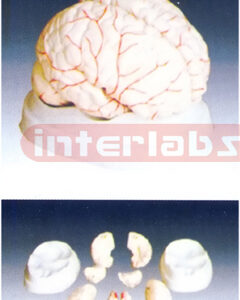 Brain with Arterial