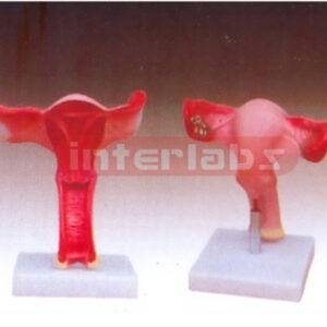 Magnified Uterus Model