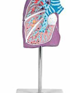 Pathological Model of the Lung
