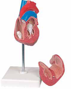 Heart Hypertrophy