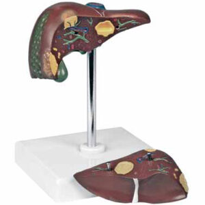 Pathological Model of the Liver