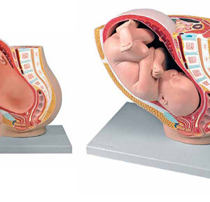 Pregnancy Pelvis with Mature Fetus
