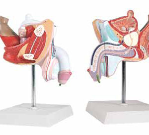 Pathological Model of the Male Urogenital System