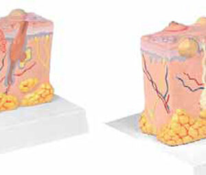 Pathological Model of the Skin