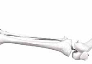 Skeleton of Lower Limb with Half Pelvis