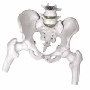 Model of Pelvis with 4th and 5th Lumbar Vertebrae with Femur Heads