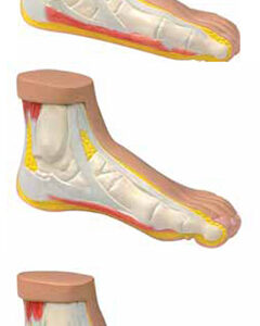 Normal and Abnormal Foot