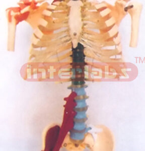 HUMAN DISEASE SKELETAL TORSO MODEL