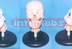 BIG ADVANCED FLEXIBLE SKULL MODEL WITH CER. VERT AND ARBITRARITY CHANGING