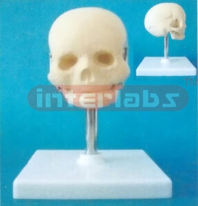 FETAL SKULL