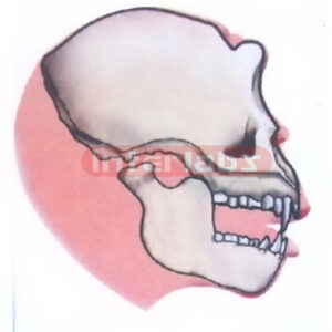 OREOPITHECUS