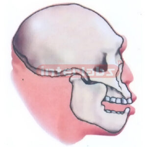 MAUER JAW OR HEIDELBERG MAN