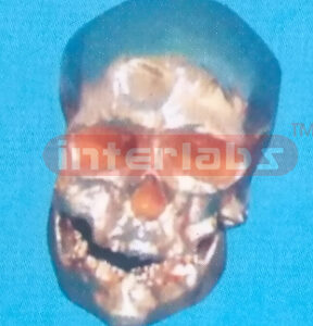COPPERIZED CROMAGNON MAN SKULL