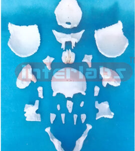 DISARTICULATED SKULL WITH 22 PARTS