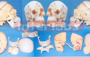 BIG ADVANCED HUMAN SKULL ASSEMBLABLE AND SEPARATABLE MODEL ARBITRARILY