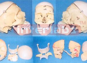 BIG ADVANCED HUMAN SKULL ASSEMBLABLE AND SEPARATABLE MODEL ARBITRARILY