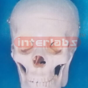 BIG BONECOLOUR SKULL WITH 3 REMOVABLE TEETH