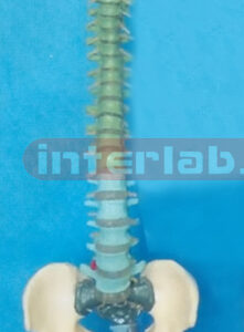 GIANT FLEXIBLE DIDACTICALLY PAINTED VERTEBRAE WITH PELVIS, OCCIPITAL BONE, VERTEBRAE ARTERY AND DORSAL HERNIATED DISC BETWEEN 3RD AND 4TH LUMBAR VERTEBRAE & LUXURY HANGING STAND
