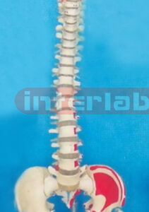 GIANT FLEXIBLE DIDACTICALLY PAINTED VERTEBRAE WITH PELVIS, OCCIPITAL BONE, VERTEBRAE ARTERY AND DORSAL HERNIATED DISC BETWEEN 3RD AND 4TH LUMBAR VERTEBRAE & LUXURY HANGING STAND