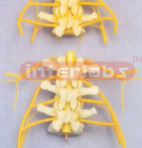THREE VERTEBRAE WITH NERVES