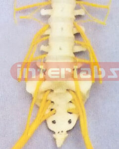 LUMBAR VERTEBRAE