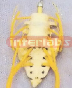 LUMBAR VERTEBRAE AND SACRUM WITH NERVES