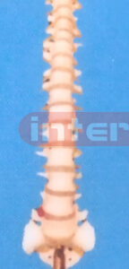 BIG RIGID VERTBRAE WITH IRON STAND