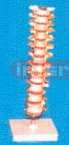 GIANT THORACIC VERTCOLUMN