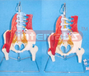 LUMBAR SPINE (PATHOLOGICAL CHANGES) WITH MUSCLES