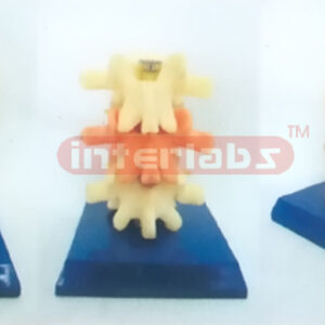BIG HUMAN VERTEBRAL COLUMM DEMONSTRATING MODEL FOR CHANGING CONDITIONS BY LIGHTING AND SOUNDING