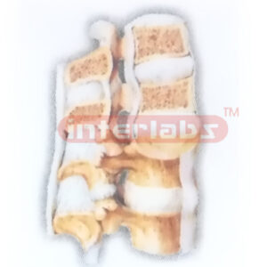HUMAN INTERVERTEBRAL JOINTS (MEDIAN SAGITTAL SECTION) MODEL