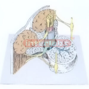 OBIGUE SECTION THROUGH THE FIRST LUMBAR, VERTEBRA SHOING THE SPINAL CORD AND ITS COVERING MEMBRANES