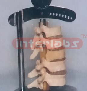 BIG VERTEBRAL ACTION CHANGE DEMONSTRATION
