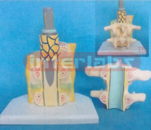 THE RELATION MODEL OF SPINAL MARROW AND VERTEBRAE. SHOWING THE RELATION BETWEEN VERTEBRAE. SPINAL CORD AND RIDGE NERVES