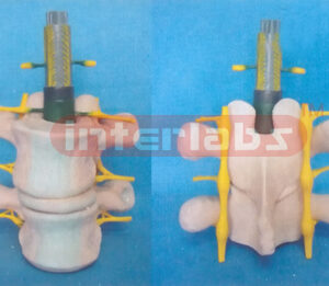 NORMAL LUMBAR COLUMN, ANATOMICAL ANDMAGNIFIED