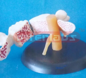 GIANT VERTEBRAE SHOWING ARTHRITIS AND OSTEOPOROSIS