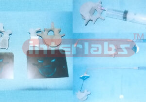 HUMAN SPINE OSTEOPOROSIS TREATMENT MODEL FQR DEMONSTRATING AND BY POURING INTO THE STUFF MATERIAL