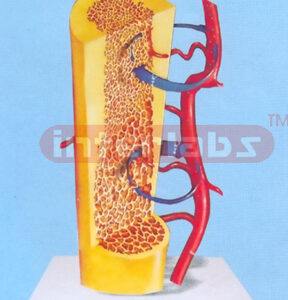 BONO DEMONSTRATION MODEL FOR, OSTEOPORSIS CAUSED BY CA MISSING