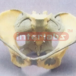 FEMALE PELVIS, LIGAMENTED
