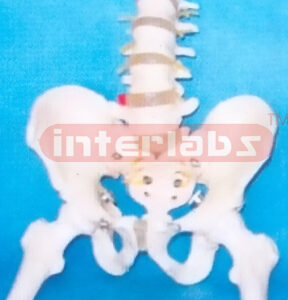 MALE PELVIS WITH 5 LUMBARS & FEMUR HEADS