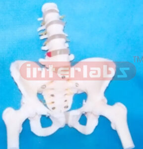 FEMALE PELVIS WITH 5 LUMBARS & FEMUR HEADS