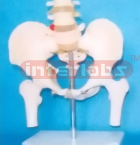 MALE PELVIS WITH 3 LUMBARS & FEMUR HEADS ON BASE