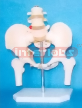 MALE PELVIS WITH 3 LUMBARS & FEMUR HEADS ON BASE