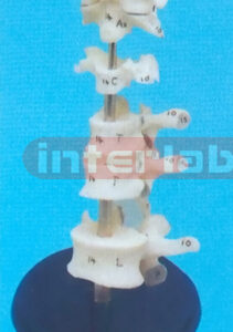 ULTRA VERTEBRAE REPRESENTATION MODEL WITH PLASTIC ROUD BASE